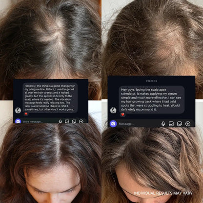 SCALP APEX STIMULATOR™ - NEVAELABS