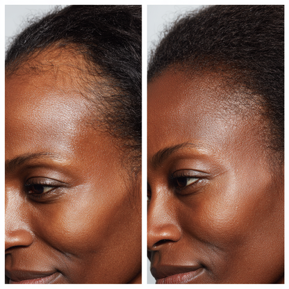 Advanced Hair Growth Massage Comb