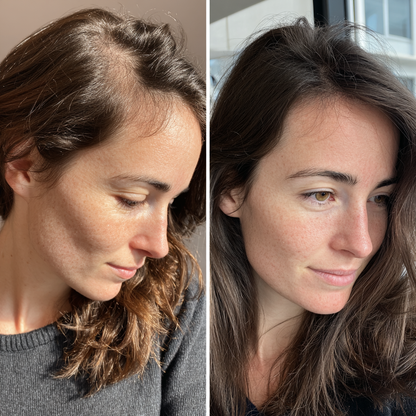 Advanced Hair Growth Massage Comb